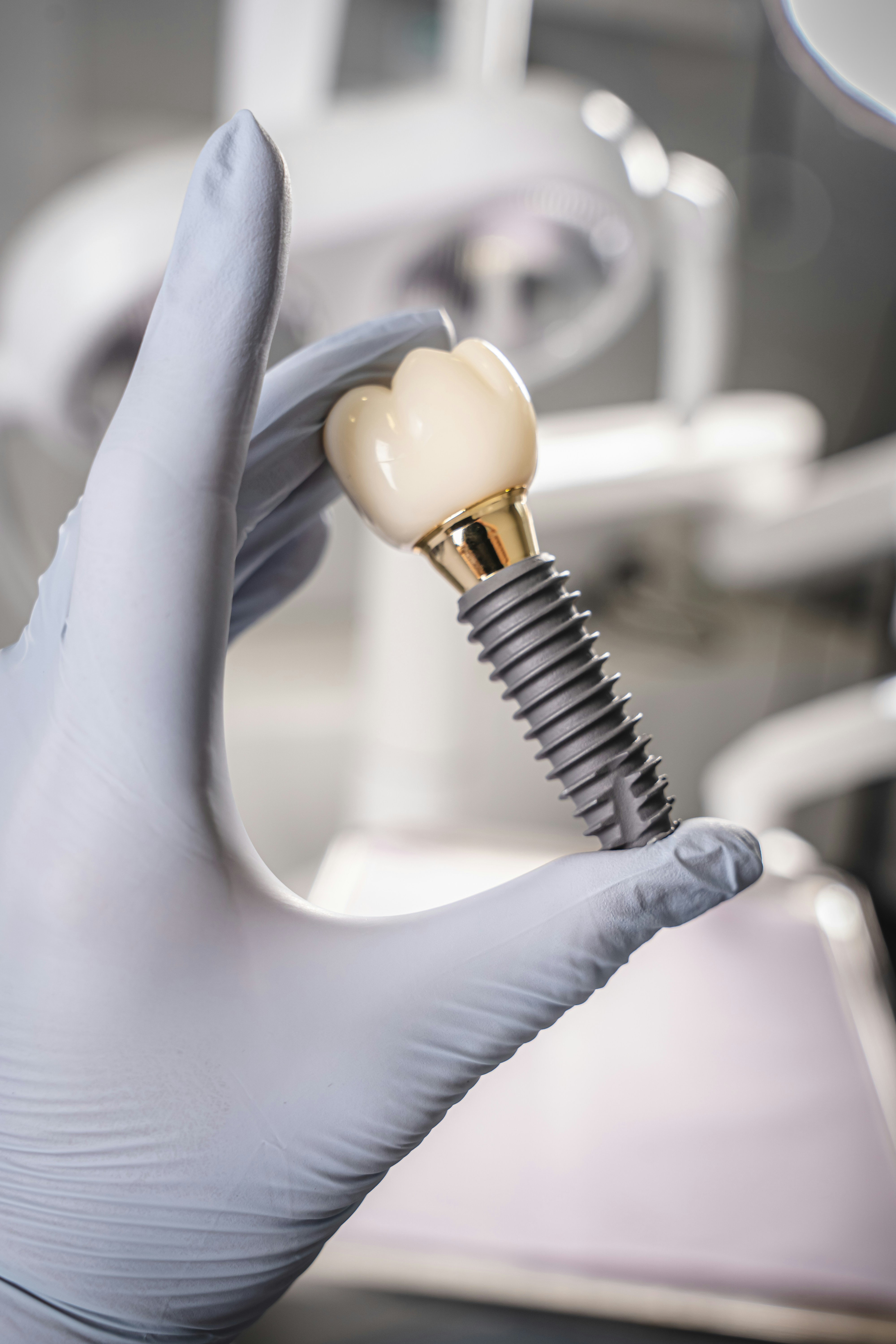 Implant dentar
